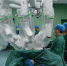 “三头四臂”手术机器人落户河北省胸科医院 - 中国新闻社河北分社