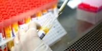 资料图：安徽理工大学第一附属医院PCR实验室内，检验人员在生物安全柜里将待检样本加入核酸提取试剂盒。 陈彬 摄 - 中国新闻社河北分社
